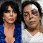 ¡IMPACTANTE! Imagen que atribuyen a Verónica Castro hospitalizada tras una supuesta agresión causa alarma en redes