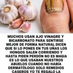 Hongos en las Uñas: ¿Ajo, Vinagre y Bicarbonato Realmente Pueden Eliminarlos?